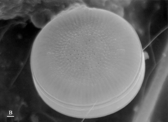  diatom sem image