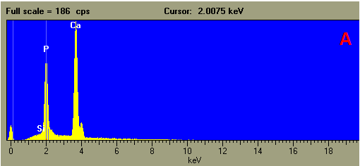 EDS example Fossil inside a tertiary limestone: spectrum spot A