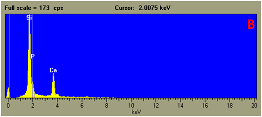 EDS example Fossil inside a tertiary limestone: spectrum spot B
